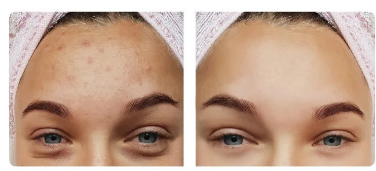 Clay Mask Detox - Baby Food Mill review and price