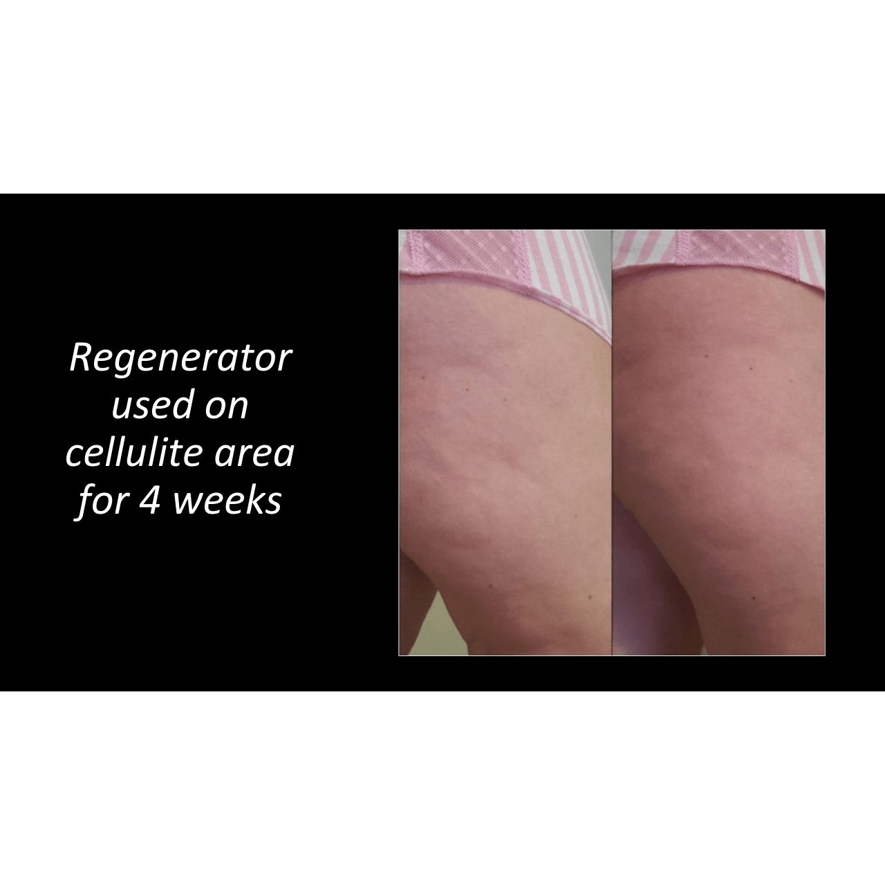 The Regenerator-Apple Cider Vi - Baby Food Mill review and price